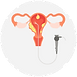 Hysteroscopy
